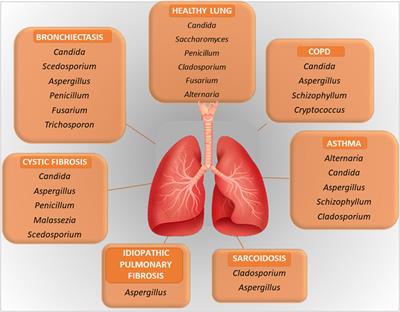 Bacteria and fungi of the lung: allies or enemies?